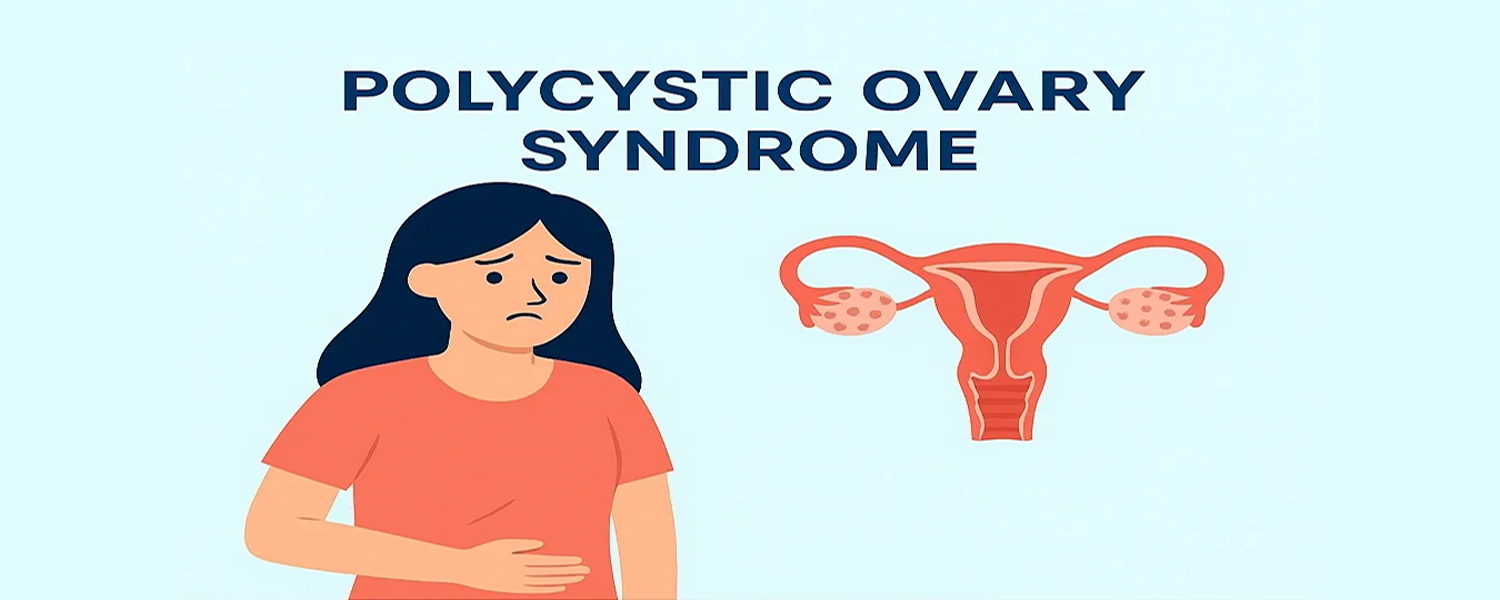 PCOS